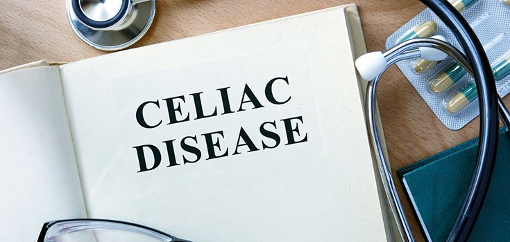 Do Season and Place of Birth Increase Celiac Disease Risk?