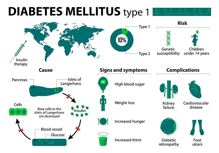 diabetes-mellitus-chart-730