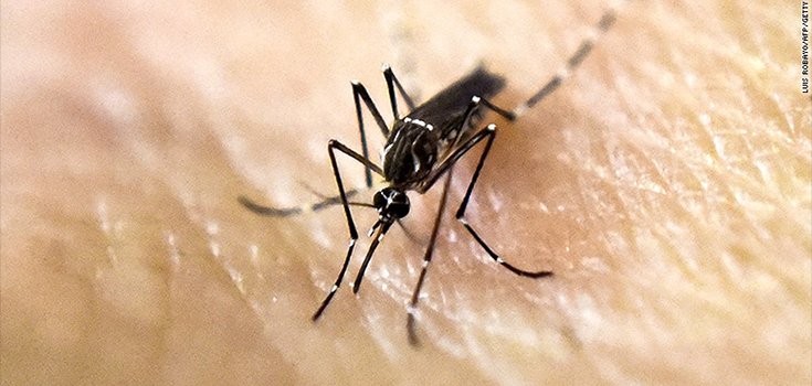 Research Suggests Zika Could Cause Long-Term Brain Issues