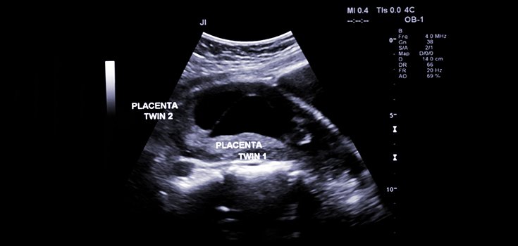 Science is Now Focusing more on Researching the Placenta