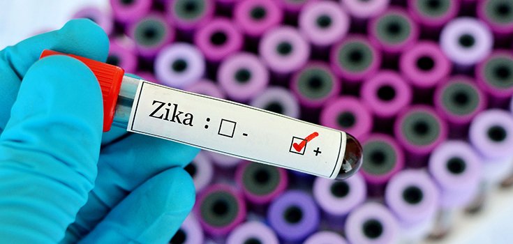 Zika Transmitted by Man with No Symptoms
