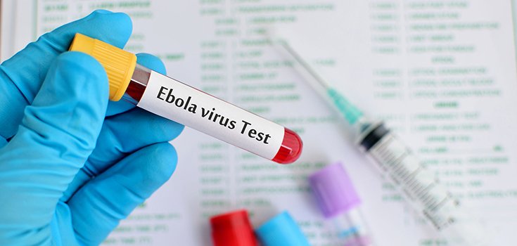 ebola virus test