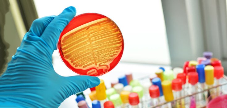 Scientists Modify Antibiotics to “Rip Apart” Superbugs in Minutes