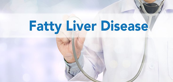 Western Diet Found to Increase Risk of Fatty Liver Disease