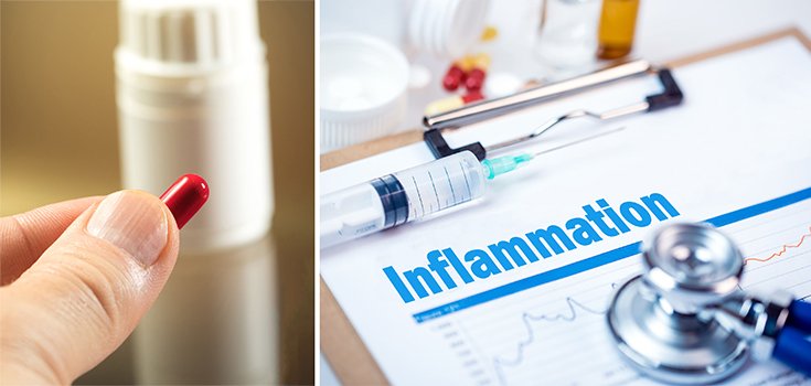 How the Gut, Probiotics May Influence Inflammaging