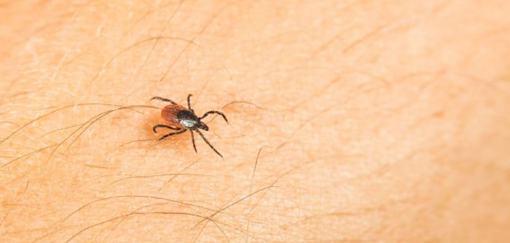 Fears of Tick-Borne Powassan Virus Increasing, Experts Warn