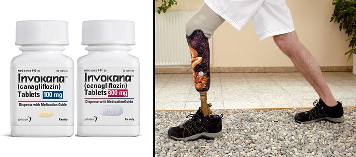 FDA: Invokana Diabetes Drug Increases Risk of Foot and Leg Amputations