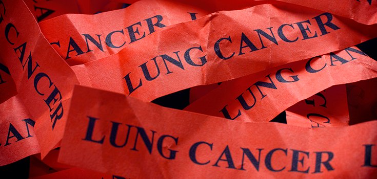 Study Links Diets High in Saturated Fat to Lung Cancer
