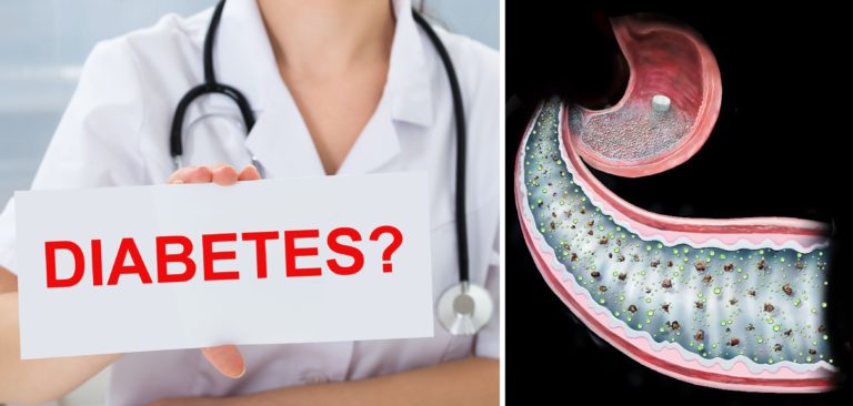 New ‘Surgery in a Pill’ Might Reverse Type 2 Diabetes