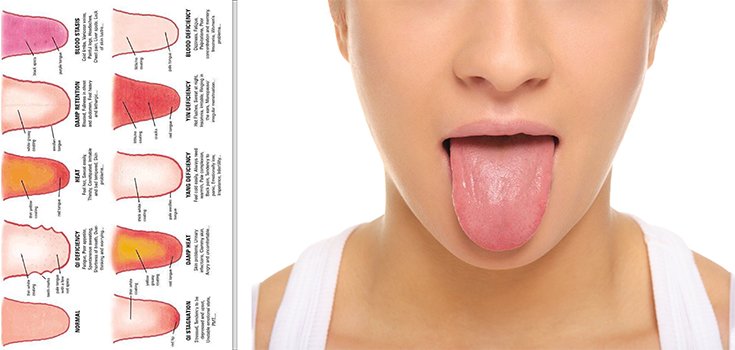 The Appearance of Your Tongue Says a Lot About Your Health