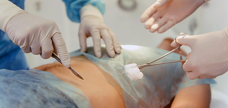 Surgery for Appendicitis Might Not be Necessary After All