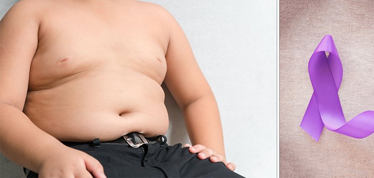 Being Overweight During Adolescence may Increase Pancreatic Cancer Risk
