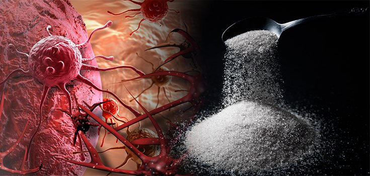 Starving Cancer to Death by Removing One Food: Refined Sugar
