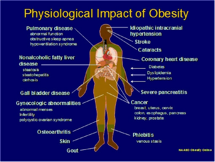 Source: Drexel Medicine