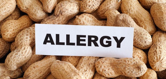 peanut allergy