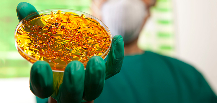 bacteria petri dish