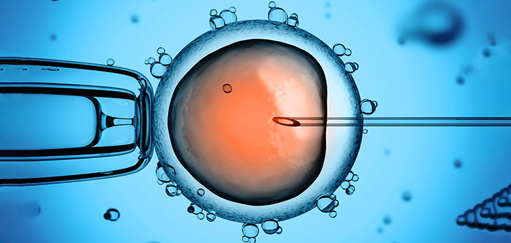 ivf