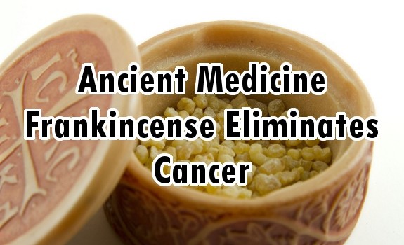 Frankincense