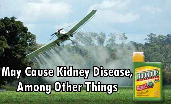 Roundup