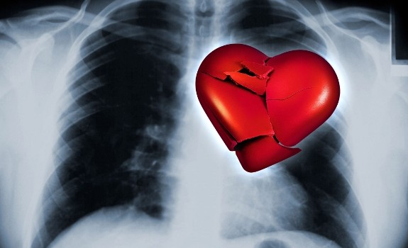 heart