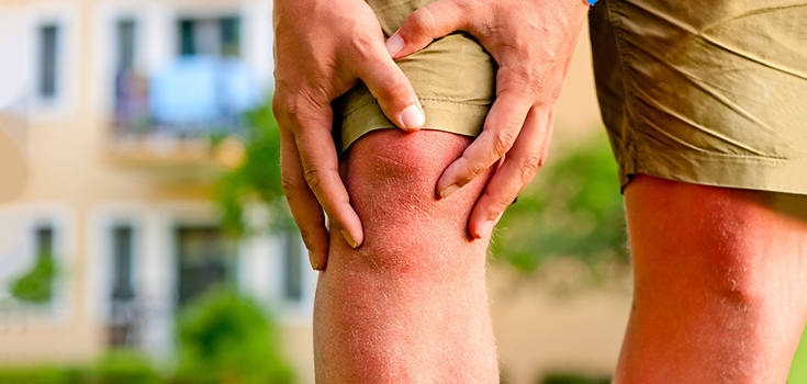 knee arthritis